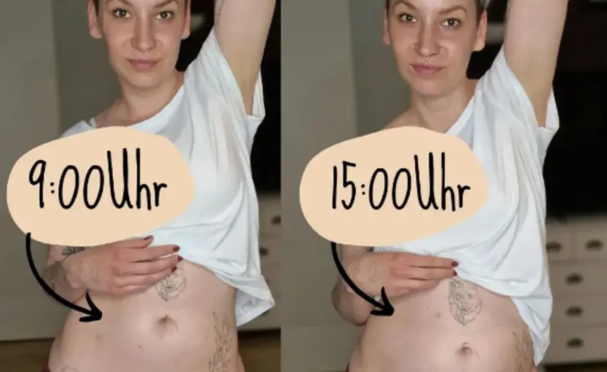 Endometrioza brzuch jak balon – przyczyny wzdęć i skuteczne metody łagodzenia